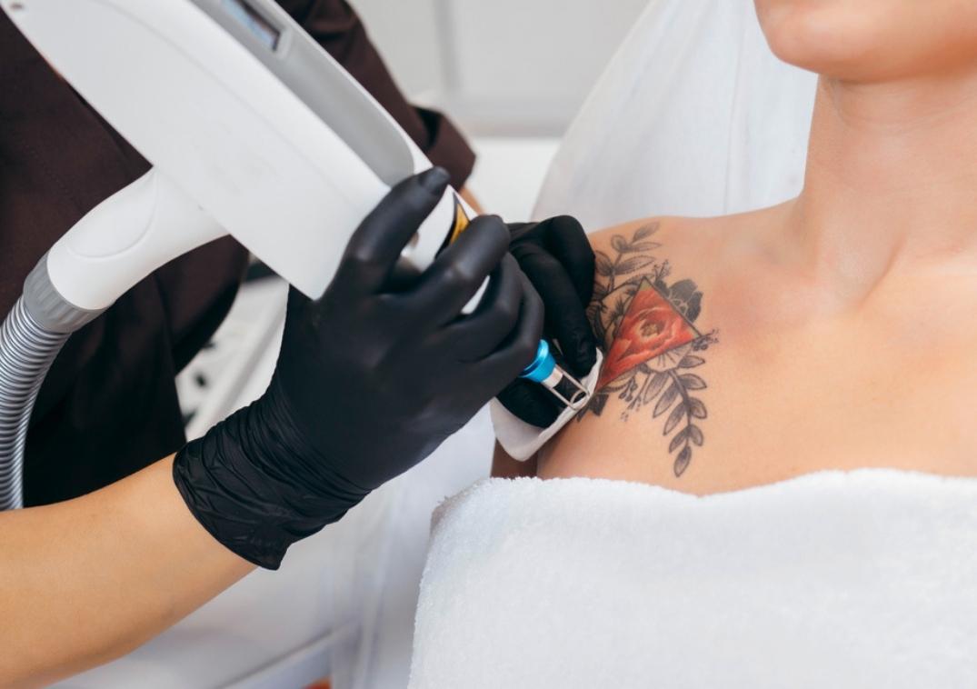 Saline Tattoo Removal For Permanent Makeup